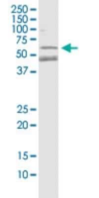 Western Blot: Parkin Antibody (1H4) [H00005071-M01]