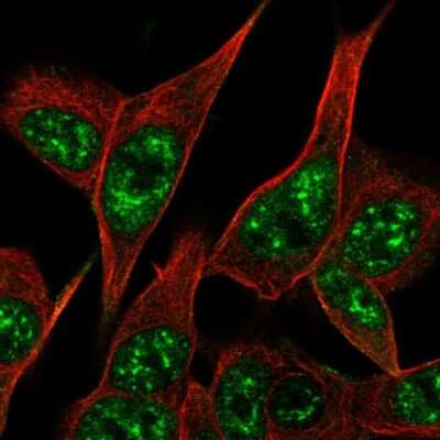 Immunocytochemistry/ Immunofluorescence: Parkin Antibody [NBP2-68629]