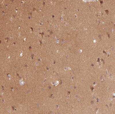 Immunohistochemistry-Paraffin: Parkin Antibody [NBP2-68629]