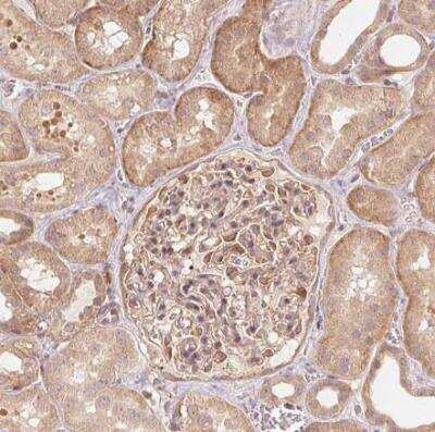 Immunohistochemistry-Paraffin: Parkin Antibody [NBP2-68629]