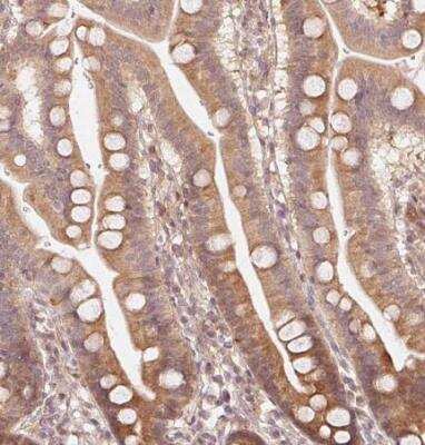 Immunohistochemistry-Paraffin: Parkin Antibody [NBP2-68629]