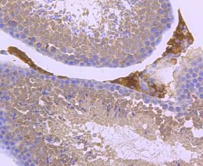 Immunohistochemistry-Paraffin: Parkin Antibody (JF82-09) [NBP2-67017]