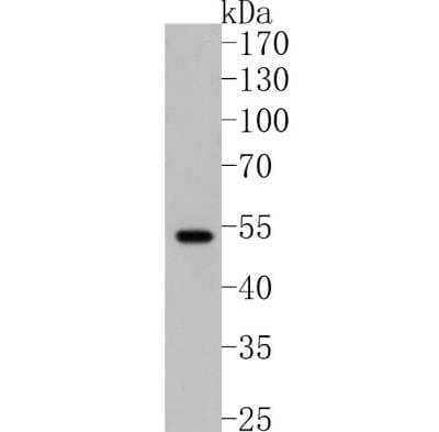 Western Blot: Parkin Antibody (JF82-09) [NBP2-67017]