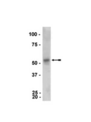 Western Blot: Parkin Antibody (PRK8) [NBP2-29838]