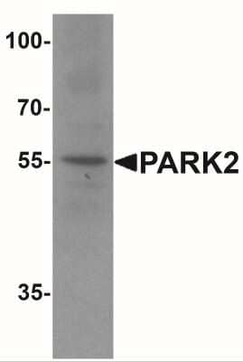 Western Blot: Parkin AntibodyBSA Free [NBP2-41287]