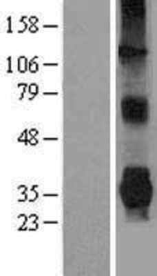 Western Blot: Parkin Overexpression Lysate [NBL1-14105]