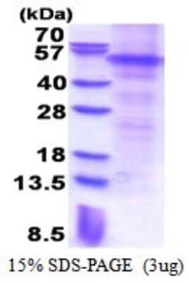 SDS-PAGE: Recombinant Human Parkin His Protein [NBP2-51533]