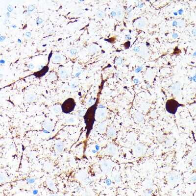 Immunohistochemistry-Paraffin: Parvalbumin Antibody (6C7K6) [NBP3-15664]