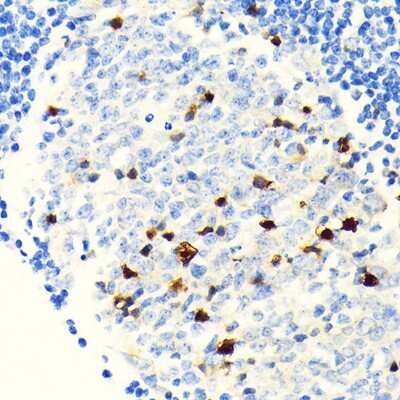 Immunohistochemistry-Paraffin: Parvalbumin Antibody (6C7K6) [NBP3-15664]