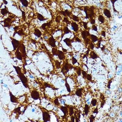 Immunohistochemistry-Paraffin: Parvalbumin Antibody (6C7K6) [NBP3-15664]