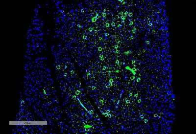 Immunohistochemistry: Parvalbumin Antibody (C12) [NBP2-79824]
