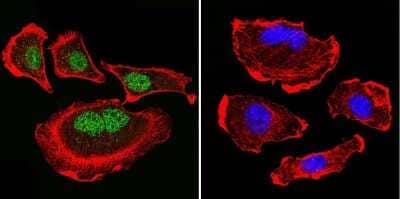 Immunocytochemistry/ Immunofluorescence: Parvalbumin Antibody - BSA Free [NB120-11427]