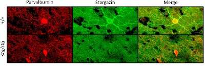 Immunohistochemistry-Paraffin: Parvalbumin Antibody - BSA Free [NB120-11427]