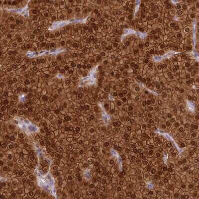 Immunohistochemistry-Paraffin: Parvalbumin Antibody [NBP2-33529]