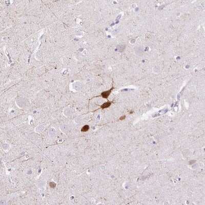 Immunohistochemistry-Paraffin: Parvalbumin Antibody [NBP2-33529]