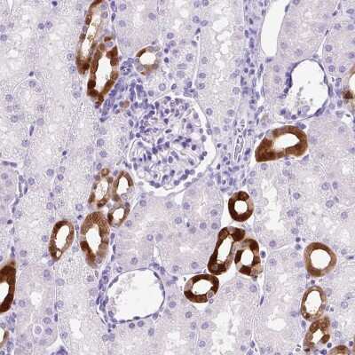 Immunohistochemistry-Paraffin: Parvalbumin Antibody [NBP2-33529]