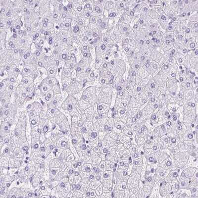 Immunohistochemistry-Paraffin: Parvalbumin Antibody [NBP2-33529]