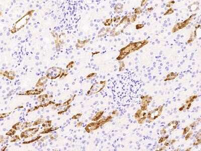 Immunohistochemistry-Paraffin: Parvalbumin Antibody [NBP2-97031]