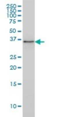 Western Blot: Parvin gamma Antibody (4E1) [H00064098-M01]