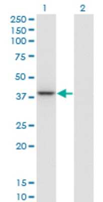 Western Blot: Parvin gamma Antibody (4E1) [H00064098-M01]