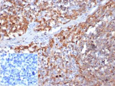 Immunohistochemistry-Paraffin: Parvin gamma Antibody (8C5.2) [NBP3-07835]