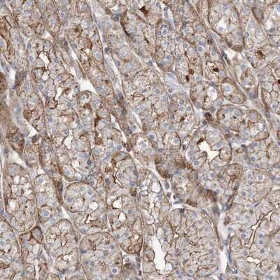 Immunohistochemistry-Paraffin: Parvin gamma Antibody [NBP2-58033]