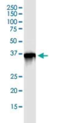 Immunoprecipitation: Parvin gamma Antibody [H00064098-D01P]