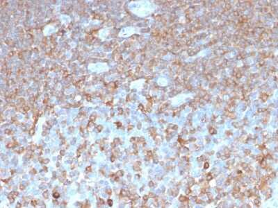 Immunohistochemistry-Paraffin: Parvin gamma Antibody (PARVG/6312R) - Azide and BSA Free [NBP3-08729]