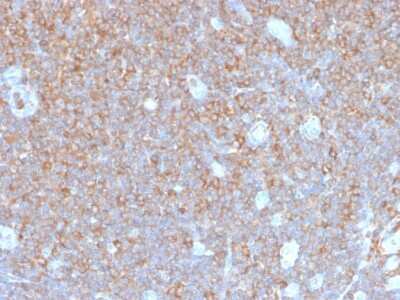 Immunohistochemistry-Paraffin: Parvin gamma Antibody (PARVG/6312R) [NBP3-07836]