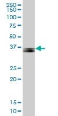 Western Blot: Parvin gamma Antibody [H00064098-B01P]