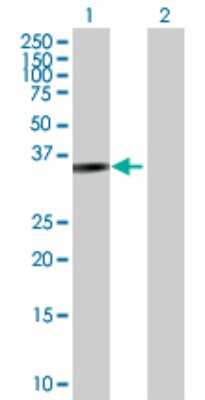 Western Blot: Parvin gamma Antibody [H00064098-D01P]