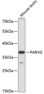 Western Blot: Parvin gamma AntibodyAzide and BSA Free [NBP2-93508]