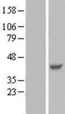 Western Blot: Parvin gamma Overexpression Lysate [NBL1-14122]