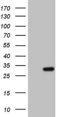 Western Blot: Patched 1/PTCH Antibody (OTI1H10) [NBP2-45439]