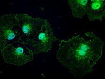 Immunocytochemistry/ Immunofluorescence: Patched 1/PTCH Antibody (OTI5C7) [NBP1-47945]
