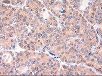 Immunohistochemistry-Paraffin: Patched 1/PTCH Antibody (OTI5C7) [NBP1-47945]
