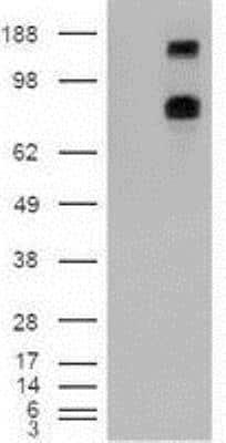 Western Blot: Patched 1/PTCH Antibody (OTI5C7) [NBP1-47945]