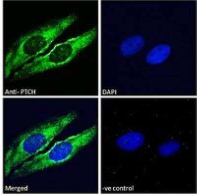 Immunocytochemistry/ Immunofluorescence: Patched 1/PTCH Antibody [NB100-2451]
