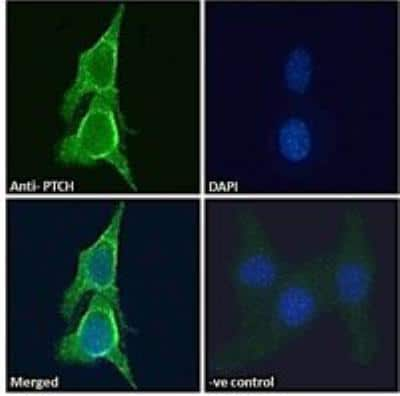 Immunocytochemistry/ Immunofluorescence: Patched 1/PTCH Antibody [NB100-2451]