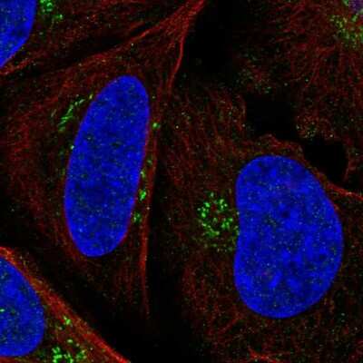 Immunocytochemistry/ Immunofluorescence: Patched 1/PTCH Antibody [NBP2-57927]