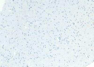 Immunohistochemistry-Paraffin: Patched 1/PTCH Antibody [NB100-2451]