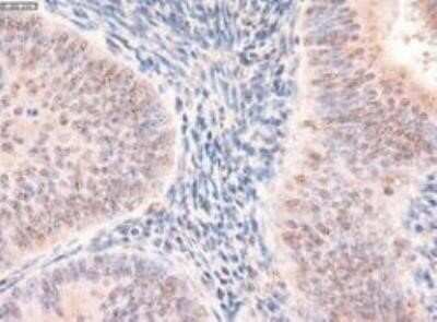 Immunohistochemistry: Patched 1/PTCH Antibody (OTI5C7) - Azide and BSA Free [NBP2-73253]