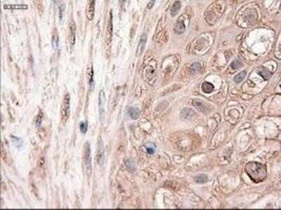 Immunohistochemistry: Patched 1/PTCH Antibody (OTI5C7) - Azide and BSA Free [NBP2-73253]