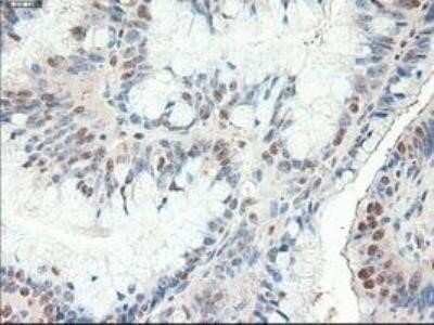 Immunohistochemistry: Patched 1/PTCH Antibody (OTI5C7) - Azide and BSA Free [NBP2-73253]