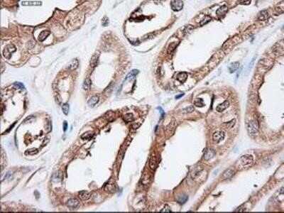 Immunohistochemistry: Patched 1/PTCH Antibody (OTI5C7) - Azide and BSA Free [NBP2-73253]