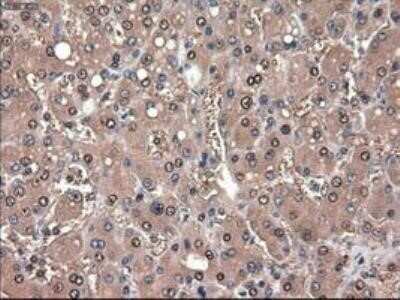 Immunohistochemistry: Patched 1/PTCH Antibody (OTI5C7) - Azide and BSA Free [NBP2-73253]
