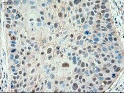 Immunohistochemistry: Patched 1/PTCH Antibody (OTI5C7) - Azide and BSA Free [NBP2-73253]