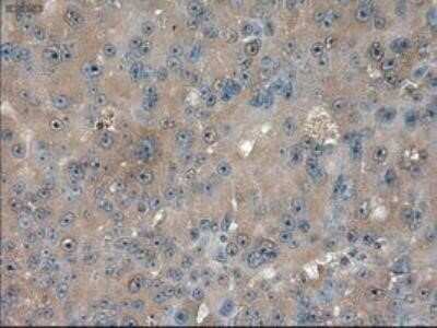 Immunohistochemistry: Patched 1/PTCH Antibody (OTI5C7) - Azide and BSA Free [NBP2-73253]