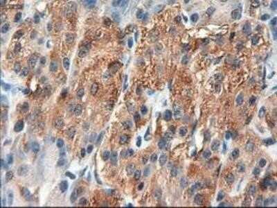 Immunohistochemistry: Patched 1/PTCH Antibody (OTI5C7) - Azide and BSA Free [NBP2-73253]