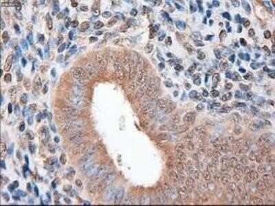 Immunohistochemistry: Patched 1/PTCH Antibody (OTI5C7) - Azide and BSA Free [NBP2-73253]